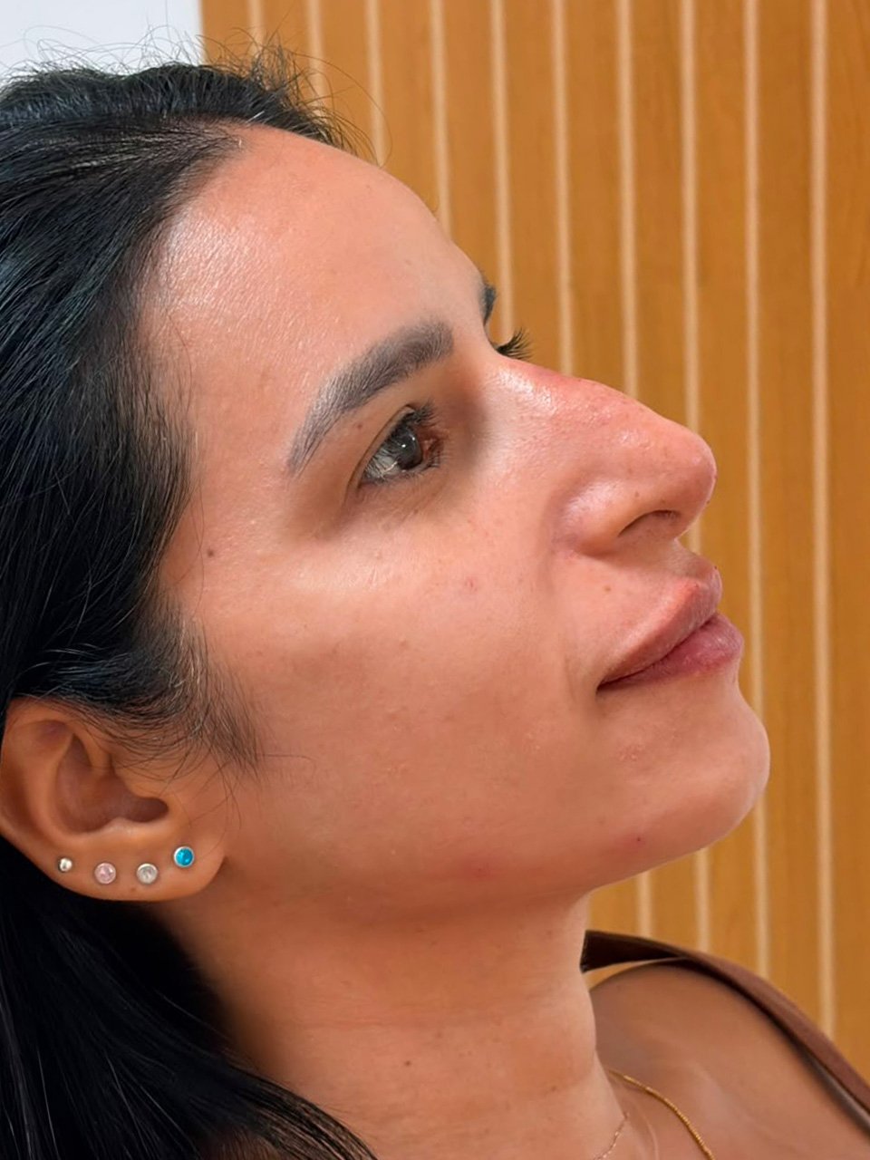 Depois — Equilíbrio e contorno